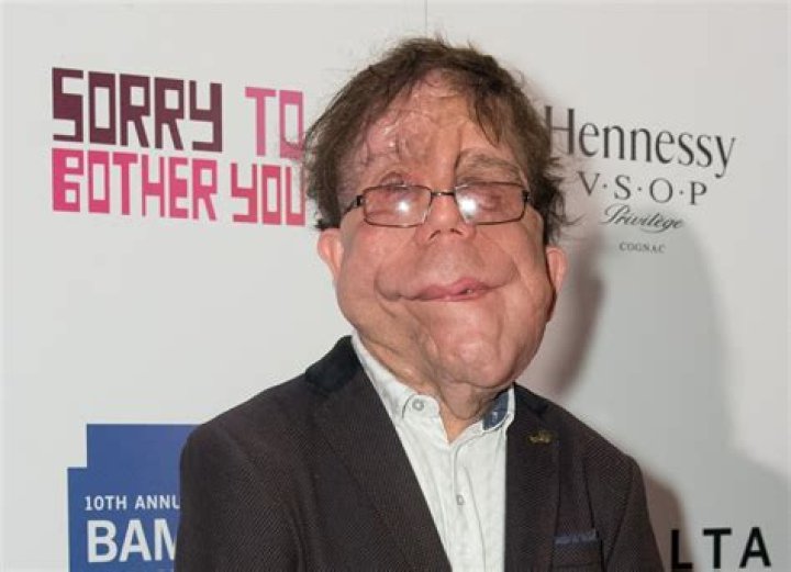 
Adam Pearson Height, Weight, Net Worth, Age, Birthday, Wikipedia, Who, Nationality, Biography 