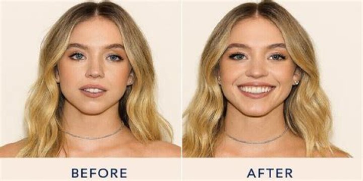 Alison Sweeney Plastic Surgery -Before And After Photos, Fans Suspect Her Facelift!