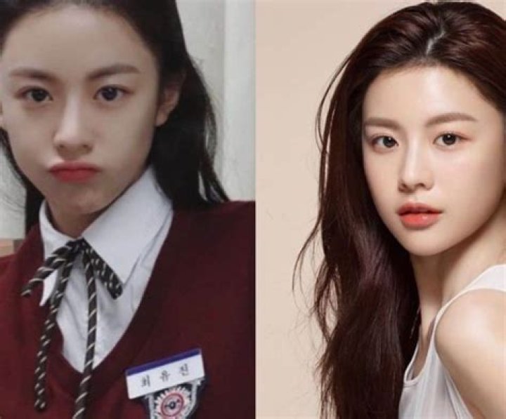 Did Go Yoon Jung Get Her Nose Done? Plastic Surgery Before And After Photos