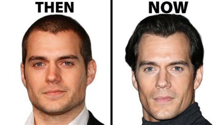 
Has Henry Cavill Had Plastic Surgery? Who is Henry Cavill? 