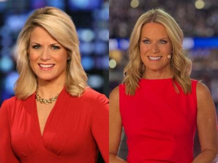 Has Martha MacCallum Done A Plastic Surgery? Before And After Photos On IG