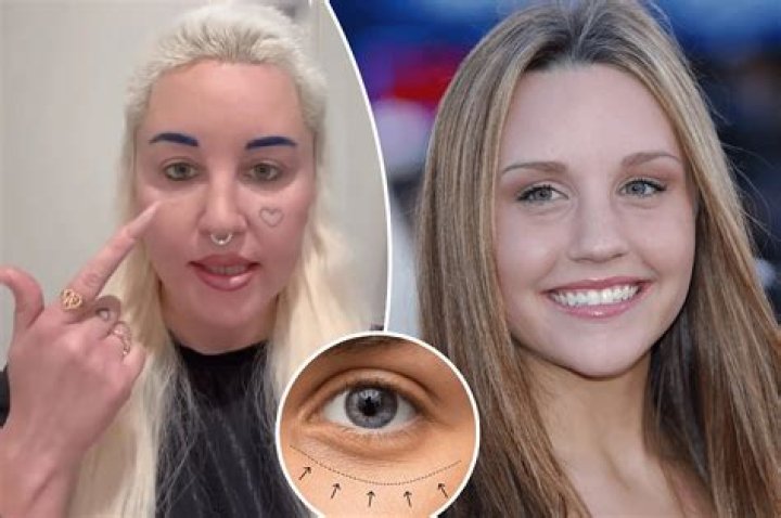 ‘Heart No More’ Amanda Bynes Face Tattoo Removal and Update, Where Is She Now 2022?