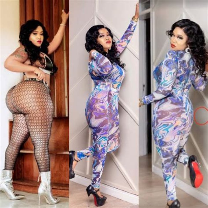 
I was given a second chance- Vera Sidika shares experience of undergoing cosmetic surgery (video) 