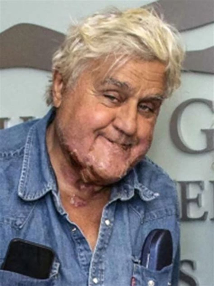 
Jay Leno’s new face: Comedian reflects on severe burn injuries on The Kelly Clarkson Show 