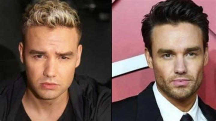 Liam Payne Before And After Looks: The One Direction Singer’s Facial Transformation Seems To Be Insane