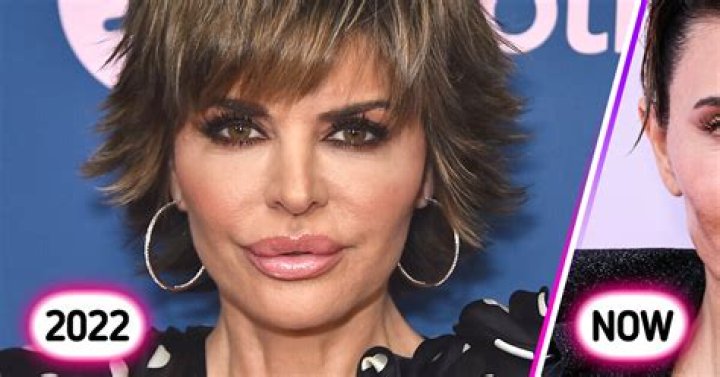 
Lisa Rinna Health News- What Is Wrong With Her? Details To Know About The Actress Health 