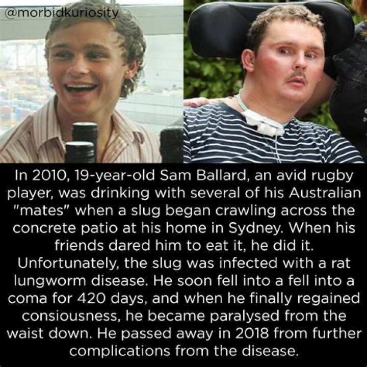 
Story: Sam Ballard Ate Slug Of Rat Lungworm On Dare – Rugby Player Death 