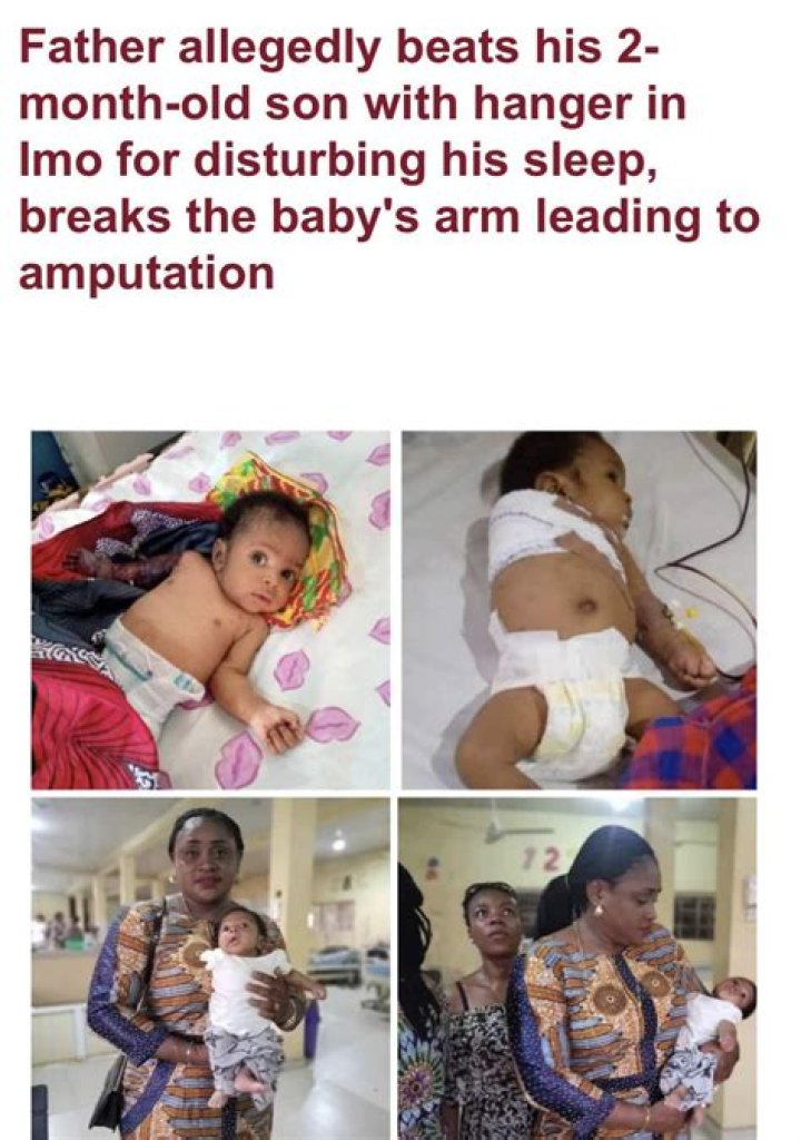 
‘This is heartbreaking,’ say celebrities in response to the story of a father who beat his 2-month-old son for disturbing his sleep, breaking the baby’s arm and forcing amputation. 