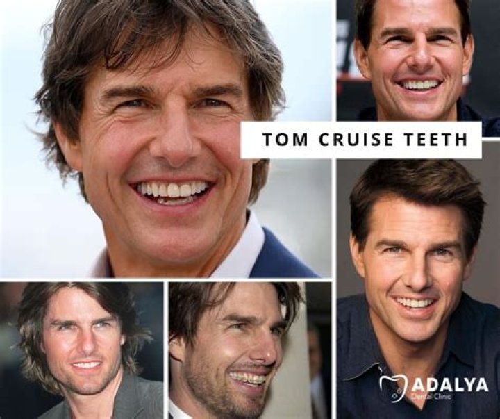 Tom Cruise Teeth – The Truth About The Actor’s Distinctive Misaligned Middle Tooth Revealed