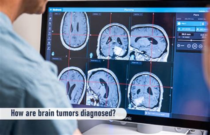 
What Happened To Joe Fonzi – Is The Journalist Diagnosed With Brain Tumor? 