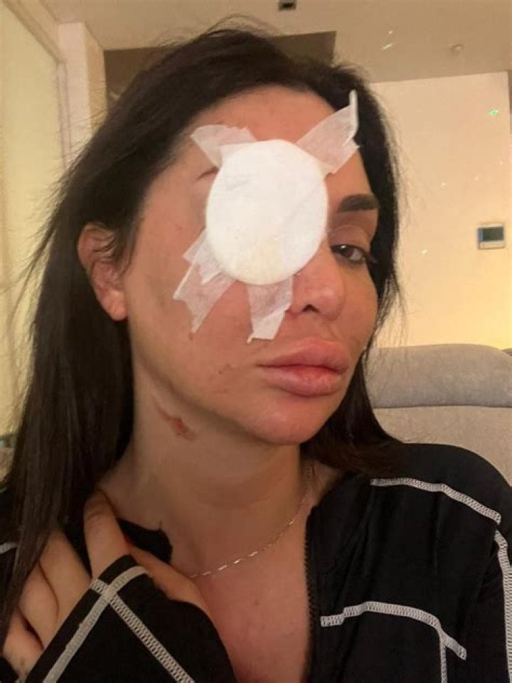 
What Happened To TikTok Star Jenny Elhassan? Acid Attack Victim From Sydney Reveals The Cause 
