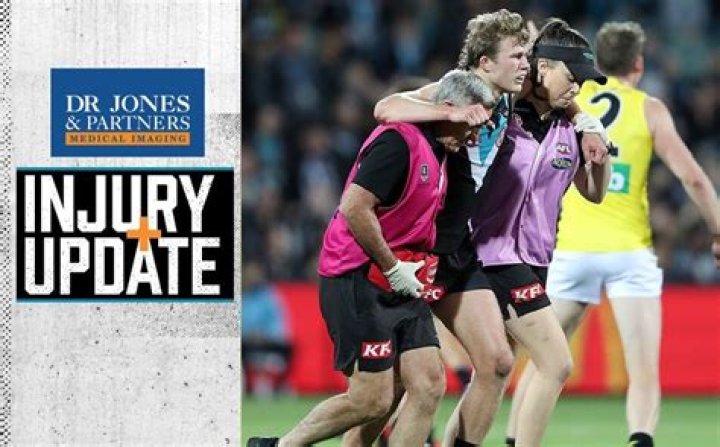 
What Happened To Xavier Duursma? Updates On His Injury And Health 