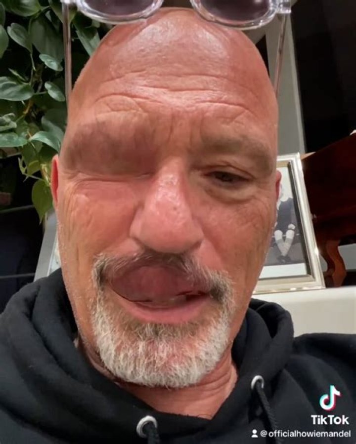 
What Illness Did Howie Mandel Have? Fans Wonder If He Is Missing AGT Due To A Disease 