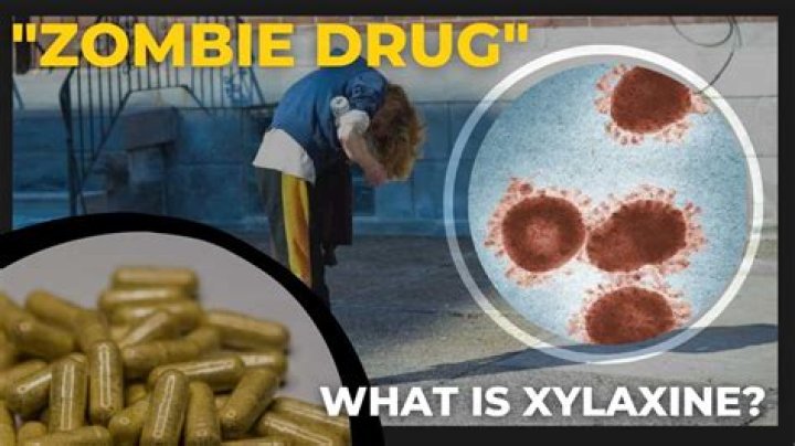 
What is Xylazine or Tranq? Know the side effects of the skin-rotting ‘zombie’ drug 