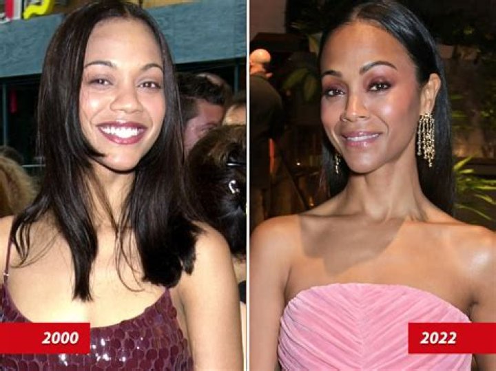 Zoe Saldana | Plastic Surgery